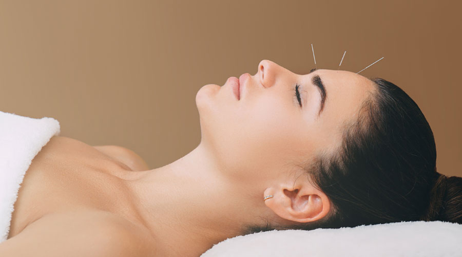 9 raisons de consulter un acupuncteur