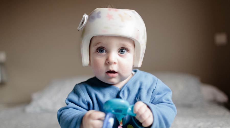 Fonctionnement des orthèses crâniennes pour enfants (casques orthopédiques)