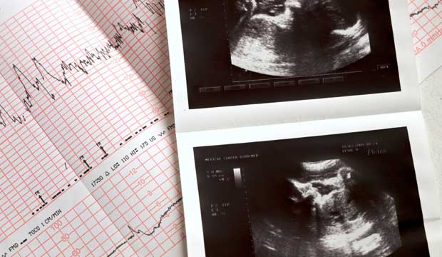 Enfant, du désir à la réalité : suivi de grossesse