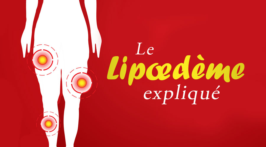 Le lipoedème expliqué : un combat quotidien pour des milliers de femmes