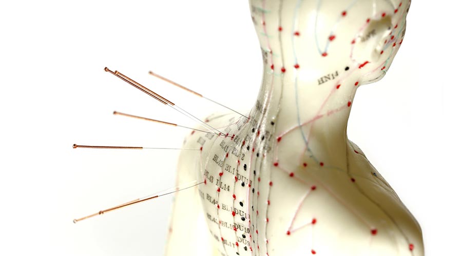 À quoi s'attendre lors d'une première séance d'acupuncture?