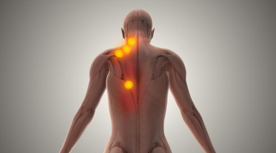 Nœuds musculaires et massothérapie : comprendre et soulager les tensions