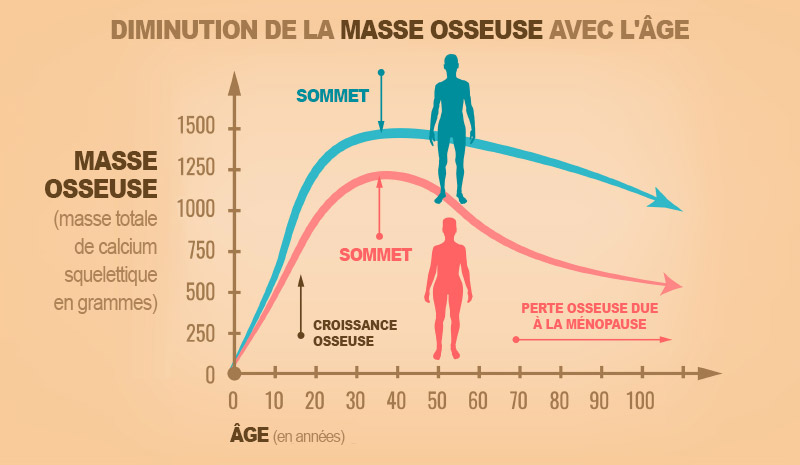 L'ostéoporose
