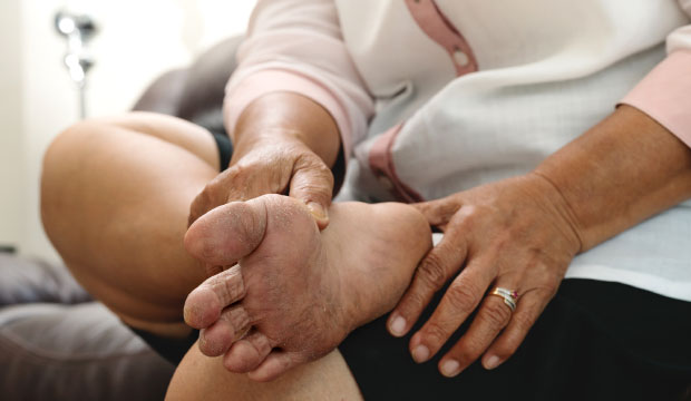 Le pied diabétique (neuropathie)