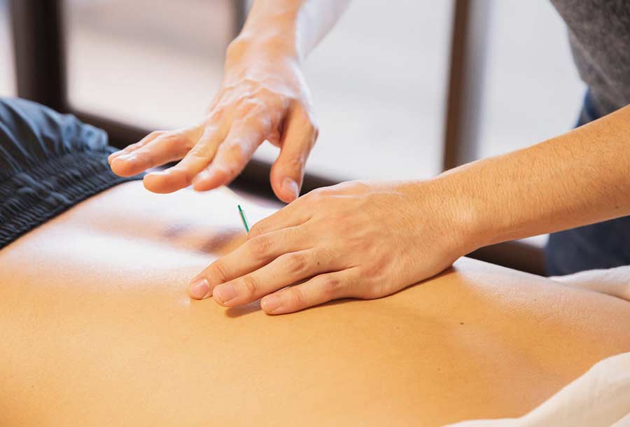 Acupuncteurs