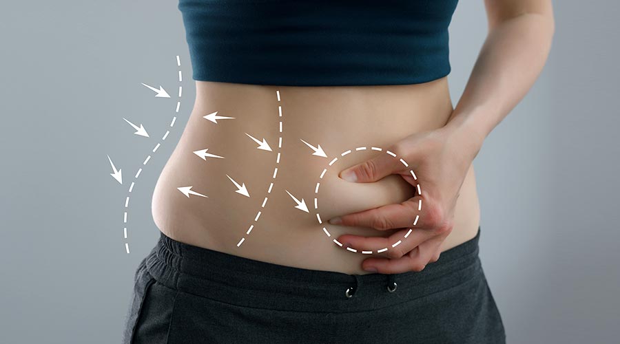 Graisse abdominale