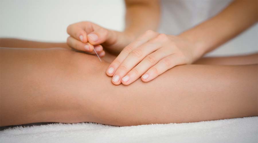 Cristina Vandoni, acupunctrice - Acupuncture Repentigny
