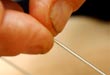 Clinique d'acupuncture Syldes, Sylvie Desjardins, Ac