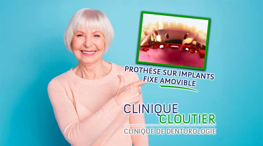 Clinique Cloutier - Denturologiste Montréal