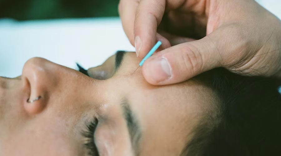 Justin Lapointe, acupuncteur - MonAcupuncteur.ca