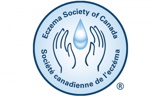 La Société canadienne de l'eczéma met les Canadiens au défi de « Vivre les démangeaisons » associées à l'eczéma
