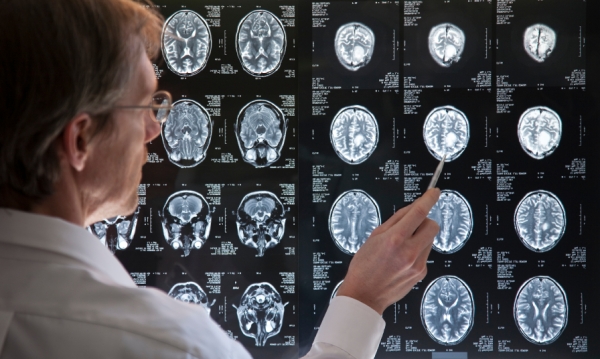 Des radiologistes de tout le pays se réunissent pour le plus important événement de radiologie du Canada 
