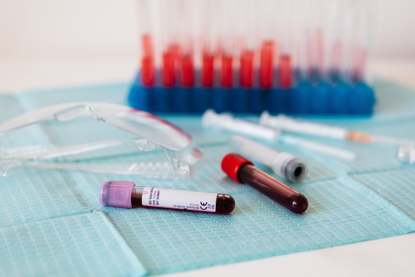 Semaine internationale du dépistage - L'accès au dépistage, étape cruciale à la prise en charge de sa santé sexuelle