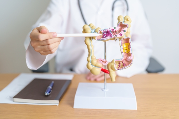 Le cancer colorectal est le deuxième cancer le plus meurtrier au Canada