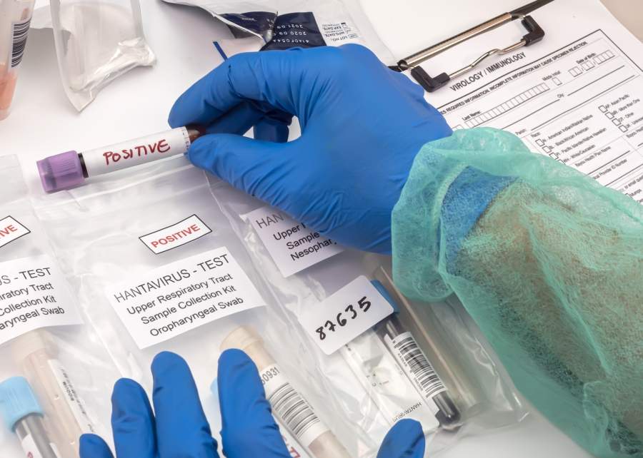 Un premier cas de hantavirus Andes confirmé au Canada