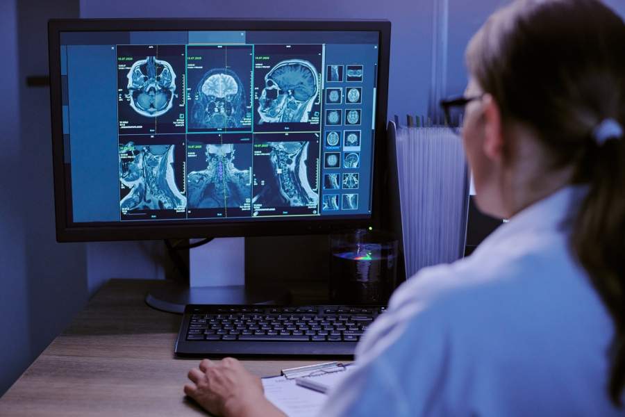 Une nouvelle plateforme d’imagerie cérébrale pour accélérer la recherche sur Alzheimer, l’autisme et Parkinson