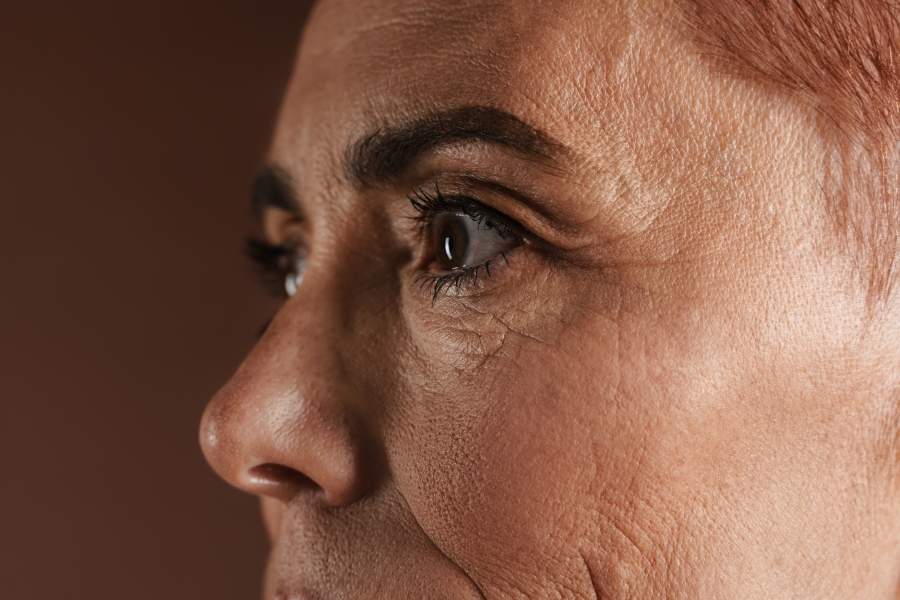 Le Québec couvre désormais les traitements contre la lipodystrophie faciale liée au VIH