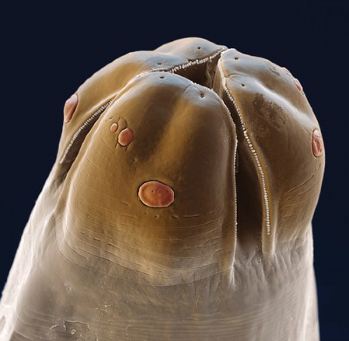 Que sont les parasites intestinaux et pourquoi devrais-je m'en préoccuper?