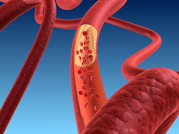 L'usage du tabac contribue à plus de 36 maladies cardiovasculaires
