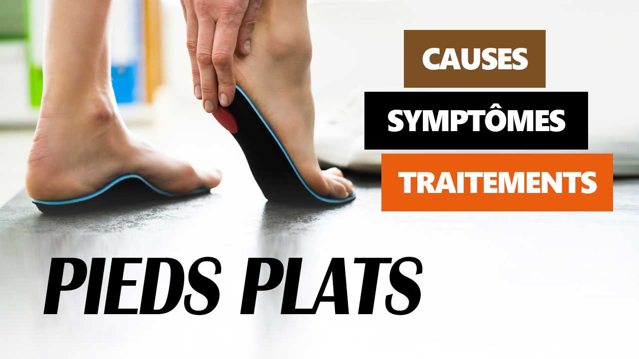 Pieds plats : causes, symptômes et traitements